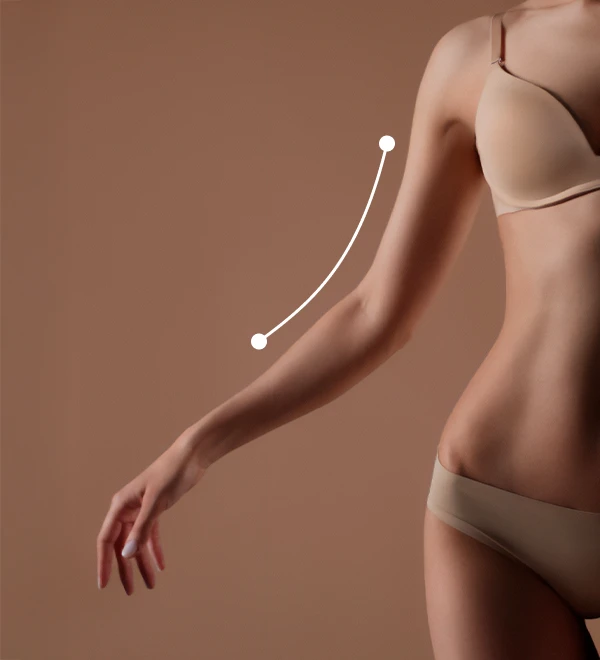 braquioplastia Mamoplastia de aumento