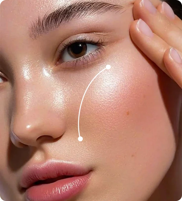 relleno_acido_hialuronico Foto blefaroplastia