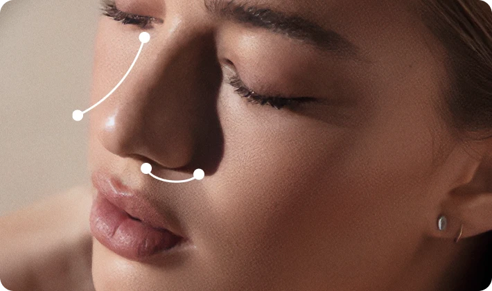 rinoplastia Foto Rinoplastia
